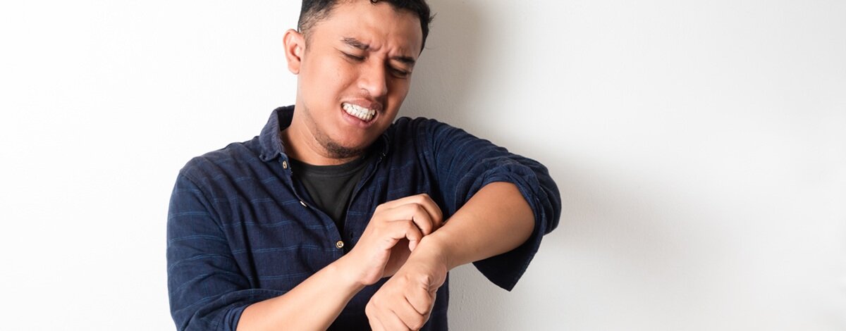 szampon na łupież pstry