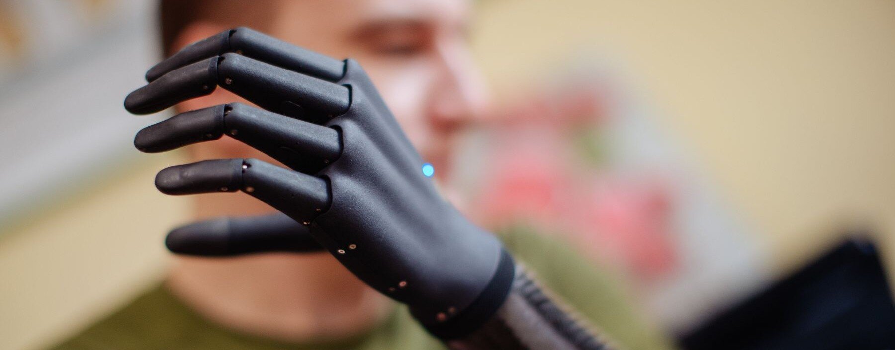 Bioniczne ręce z Ukrainy mają pomagać rannym. Esper Bionics rozwija protezy sterowane mięśniami Chętnych są setki, a produkują tylko kilka sztuk miesięcznie. Tak Ukraina walczy o bioniczne ręce dla rannych