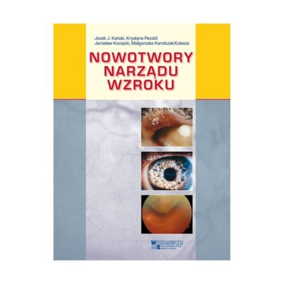 Nowotwory narządu wzroku Jacek J Kański